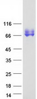 LIMPII / SCARB2 Protein - Purified recombinant protein SCARB2 was analyzed by SDS-PAGE gel and Coomassie Blue Staining