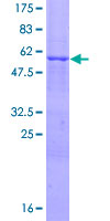 LIMS1 / PINCH Protein - 12.5% SDS-PAGE of human LIMS1 stained with Coomassie Blue