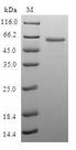 LIMS1 / PINCH Protein - (Tris-Glycine gel) Discontinuous SDS-PAGE (reduced) with 5% enrichment gel and 15% separation gel.