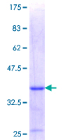 LIMS1 / PINCH Protein - 12.5% SDS-PAGE Stained with Coomassie Blue.