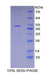 LIMS1 / PINCH Protein - Recombinant LIM And Senescent Cell Antigen Like Domains Protein 1 By SDS-PAGE