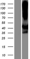 LIMS2 Protein - Western validation with an anti-DDK antibody * L: Control HEK293 lysate R: Over-expression lysate