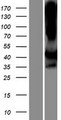 LIMS2 Protein - Western validation with an anti-DDK antibody * L: Control HEK293 lysate R: Over-expression lysate