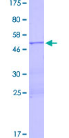 LIN28A / LIN28 Protein - 12.5% SDS-PAGE of human LIN28 stained with Coomassie Blue