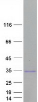 LIN28A / LIN28 Protein - Purified recombinant protein LIN28A was analyzed by SDS-PAGE gel and Coomassie Blue Staining
