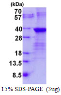 LIN28B Protein