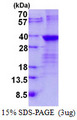 LIN28B Protein