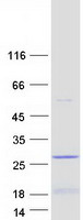 LIN52 Protein - Purified recombinant protein LIN52 was analyzed by SDS-PAGE gel and Coomassie Blue Staining