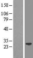 LIN7A Protein - Western validation with an anti-DDK antibody * L: Control HEK293 lysate R: Over-expression lysate