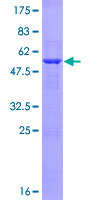 LIN7A Protein - 12.5% SDS-PAGE of human LIN7A stained with Coomassie Blue