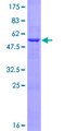 LIN7A Protein - 12.5% SDS-PAGE of human LIN7A stained with Coomassie Blue