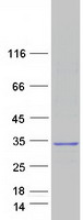 LIN7A Protein - Purified recombinant protein LIN7A was analyzed by SDS-PAGE gel and Coomassie Blue Staining
