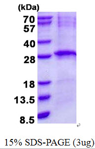 LIN7B Protein