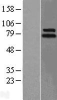LINGO1 Protein - Western validation with an anti-DDK antibody * L: Control HEK293 lysate R: Over-expression lysate
