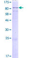 LINGO2 Protein - 12.5% SDS-PAGE of human LINGO2 stained with Coomassie Blue