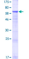 LINS1 Protein - 12.5% SDS-PAGE of human LINS1 stained with Coomassie Blue