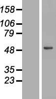 LIPA / Lysosomal Acid Lipase Protein - Western validation with an anti-DDK antibody * L: Control HEK293 lysate R: Over-expression lysate