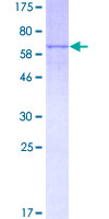 LIPA / Lysosomal Acid Lipase Protein - 12.5% SDS-PAGE of human LIPA stained with Coomassie Blue