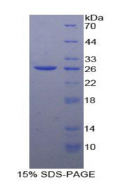 LIPC / Hepatic Lipase Protein - Recombinant Lipase, Hepatic By SDS-PAGE