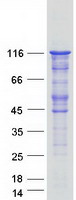 LIPE / HSL Protein - Purified recombinant protein LIPE was analyzed by SDS-PAGE gel and Coomassie Blue Staining