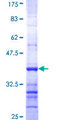LIPF / GL / Gastric Lipase Protein - 12.5% SDS-PAGE Stained with Coomassie Blue.