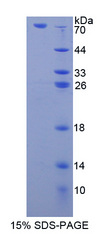LIPF / GL / Gastric Lipase Protein - Recombinant  Lipase, Gastric By SDS-PAGE