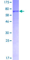 LIPG / Endothelial Lipase Protein - 12.5% SDS-PAGE of human LIPG stained with Coomassie Blue