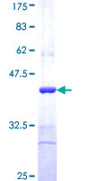 LIPG / Endothelial Lipase Protein - 12.5% SDS-PAGE Stained with Coomassie Blue.