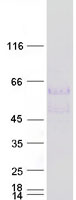 LIPG / Endothelial Lipase Protein - Purified recombinant protein LIPG was analyzed by SDS-PAGE gel and Coomassie Blue Staining