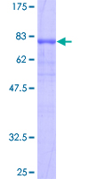 LIPH / Lipase Member H Protein - 12.5% SDS-PAGE of human LIPH stained with Coomassie Blue