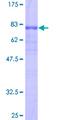 LIPH / Lipase Member H Protein - 12.5% SDS-PAGE of human LIPH stained with Coomassie Blue