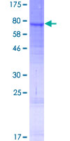 LIPI Protein - 12.5% SDS-PAGE of human LIPI stained with Coomassie Blue