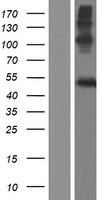 LIPM / LIPL3 Protein - Western validation with an anti-DDK antibody * L: Control HEK293 lysate R: Over-expression lysate
