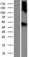 LIPN Protein - Western validation with an anti-DDK antibody * L: Control HEK293 lysate R: Over-expression lysate