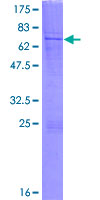 LIPT1 Protein - 12.5% SDS-PAGE of human LIPT1 stained with Coomassie Blue