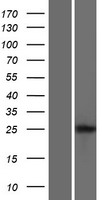 LIPT2 Protein - Western validation with an anti-DDK antibody * L: Control HEK293 lysate R: Over-expression lysate