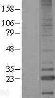 LITAF Protein - Western validation with an anti-DDK antibody * L: Control HEK293 lysate R: Over-expression lysate