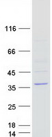 LIX1 Protein - Purified recombinant protein LIX1 was analyzed by SDS-PAGE gel and Coomassie Blue Staining