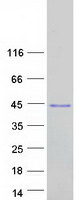 LIX1L Protein - Purified recombinant protein LIX1L was analyzed by SDS-PAGE gel and Coomassie Blue Staining