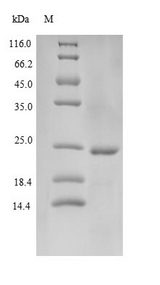 LL37 / Cathelicidin Protein - (Tris-Glycine gel) Discontinuous SDS-PAGE (reduced) with 5% enrichment gel and 15% separation gel.