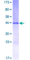 LL37 / Cathelicidin Protein - 12.5% SDS-PAGE of human CAMP stained with Coomassie Blue