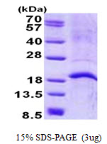 LL37 / Cathelicidin Protein