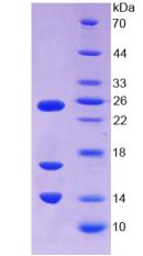 LL37 / Cathelicidin Protein - Recombinant Cathelicidin Antimicrobial Peptide By SDS-PAGE