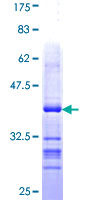 LLGL1 / HUGL Protein - 12.5% SDS-PAGE Stained with Coomassie Blue.