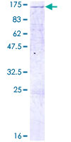 LLGL2 Protein - 12.5% SDS-PAGE of human LLGL2 stained with Coomassie Blue
