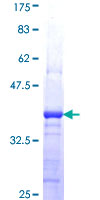 LLGL2 Protein - 12.5% SDS-PAGE Stained with Coomassie Blue.