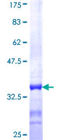 LMBR1 Protein - 12.5% SDS-PAGE Stained with Coomassie Blue.