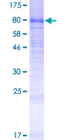 LMBRD1 Protein - 12.5% SDS-PAGE of human LMBRD1 stained with Coomassie Blue