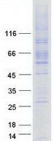 LMBRD1 Protein - Purified recombinant protein LMBRD1 was analyzed by SDS-PAGE gel and Coomassie Blue Staining