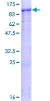 LMCD1 Protein - 12.5% SDS-PAGE of human LMCD1 stained with Coomassie Blue